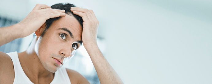 Alopecia areata, solución y tratamientos